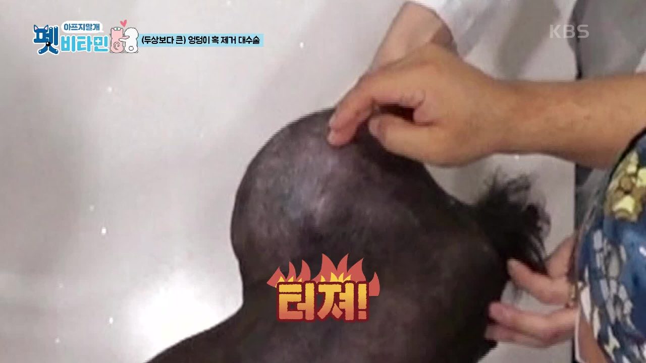 두상보다 큰 엉덩이 혹 제거 대수술.. 터질 수도 있다고? | KBS 201119 방송 - kakaoTV