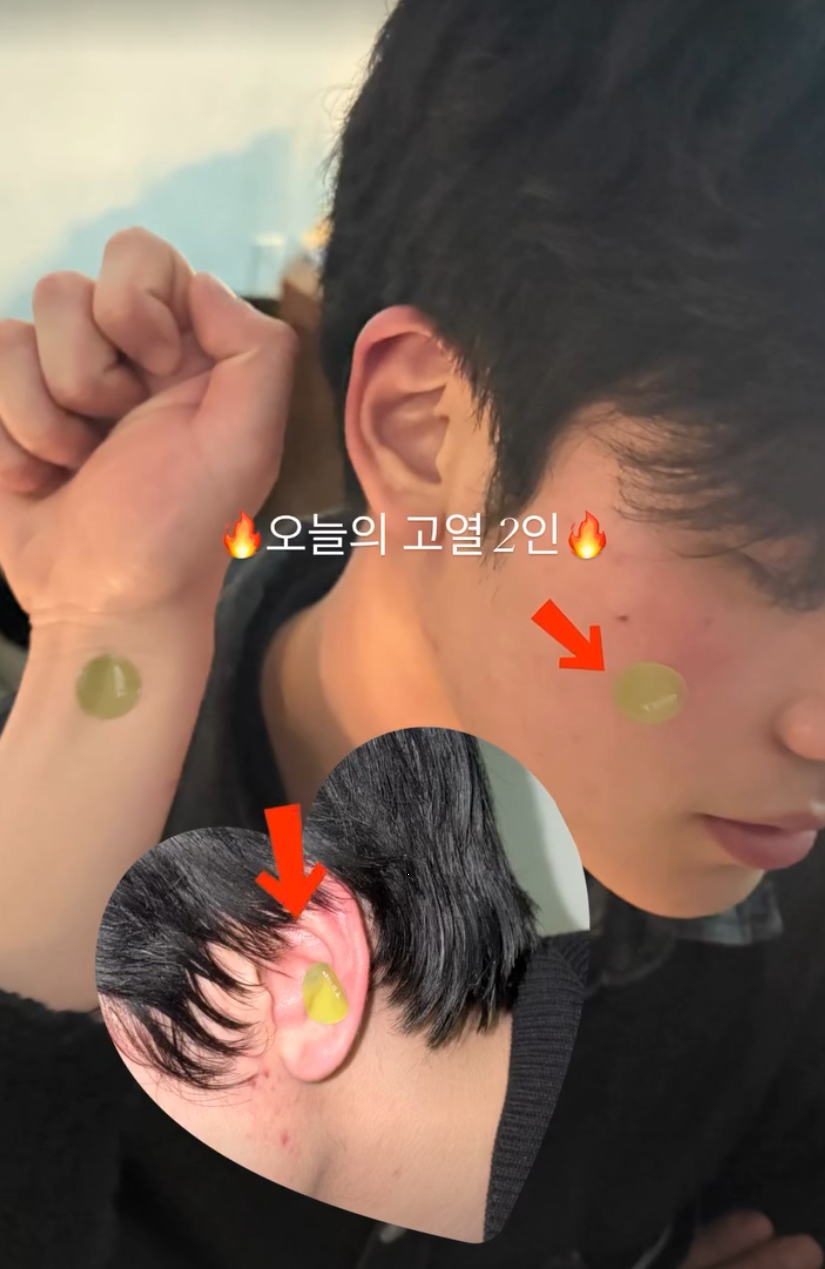 미열 사진 7
