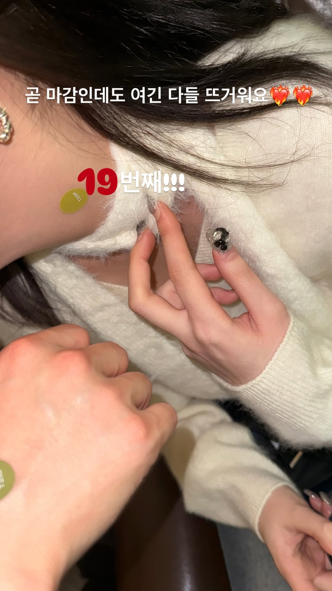 미열 사진 3